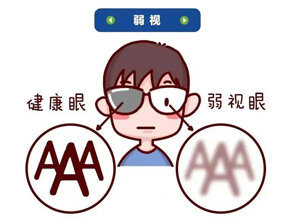 品牌学科 | 孩子弱视需早治 把握治疗黄金期