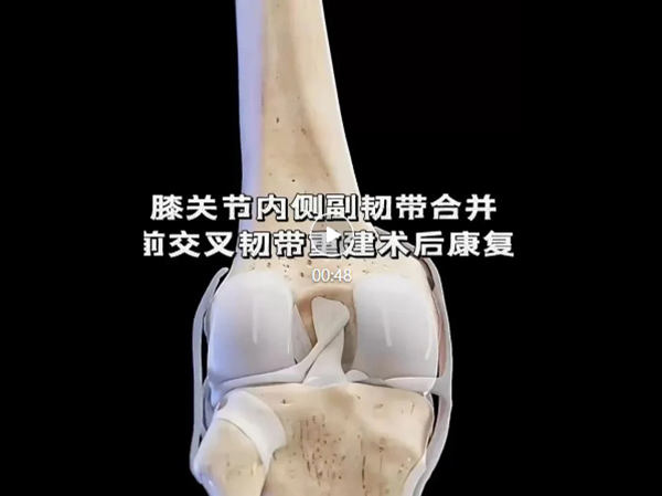 优势技术 | 前交叉韧带重建 手术不是终点术后康复加快重获运动能力