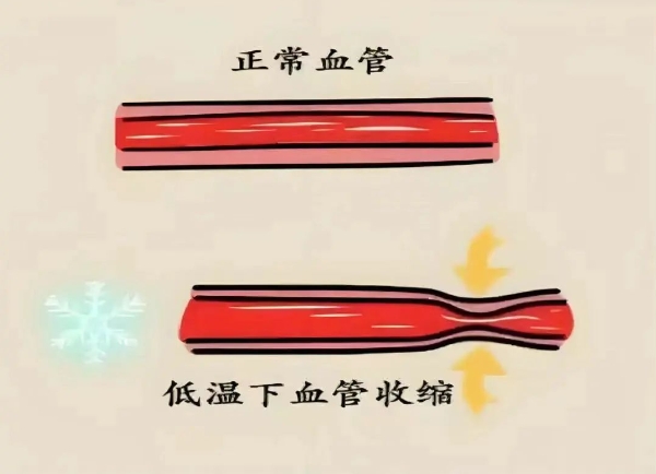 健康科普 | 冬季如何管理好血压