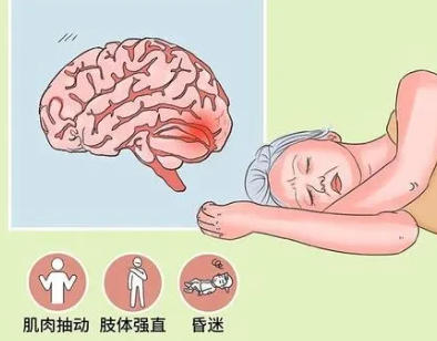 优势学科|17 年癫痫折磨终解脱！锦州市中心医院癫痫门诊规范治疗为患者点亮希望之光