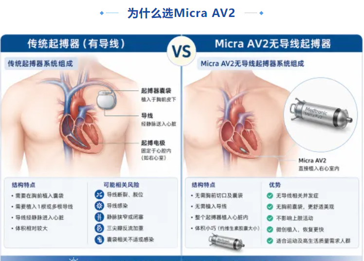 优势技术 | 告别导线束缚运动无忧，锦州市中心医院成功植入全国首批Micra AV2无导线起搏器，为冬泳爱好者重启”心”生活
